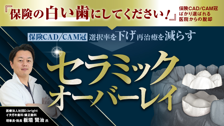 8割の患者が自費補綴を選ぶ【セラミックオーバーレイ】導入強化